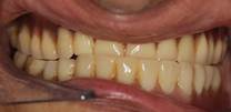Close-up of a person's mouth and teeth